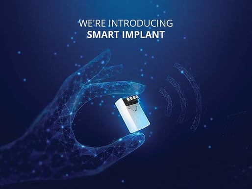 Fibaro Smart Implant Z-Wave