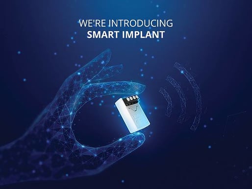 Fibaro Smart Implant Z-wave